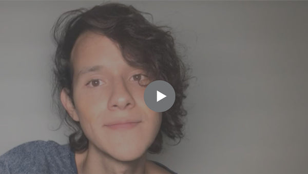 Todo acerca del acne desde mi experiencia personal