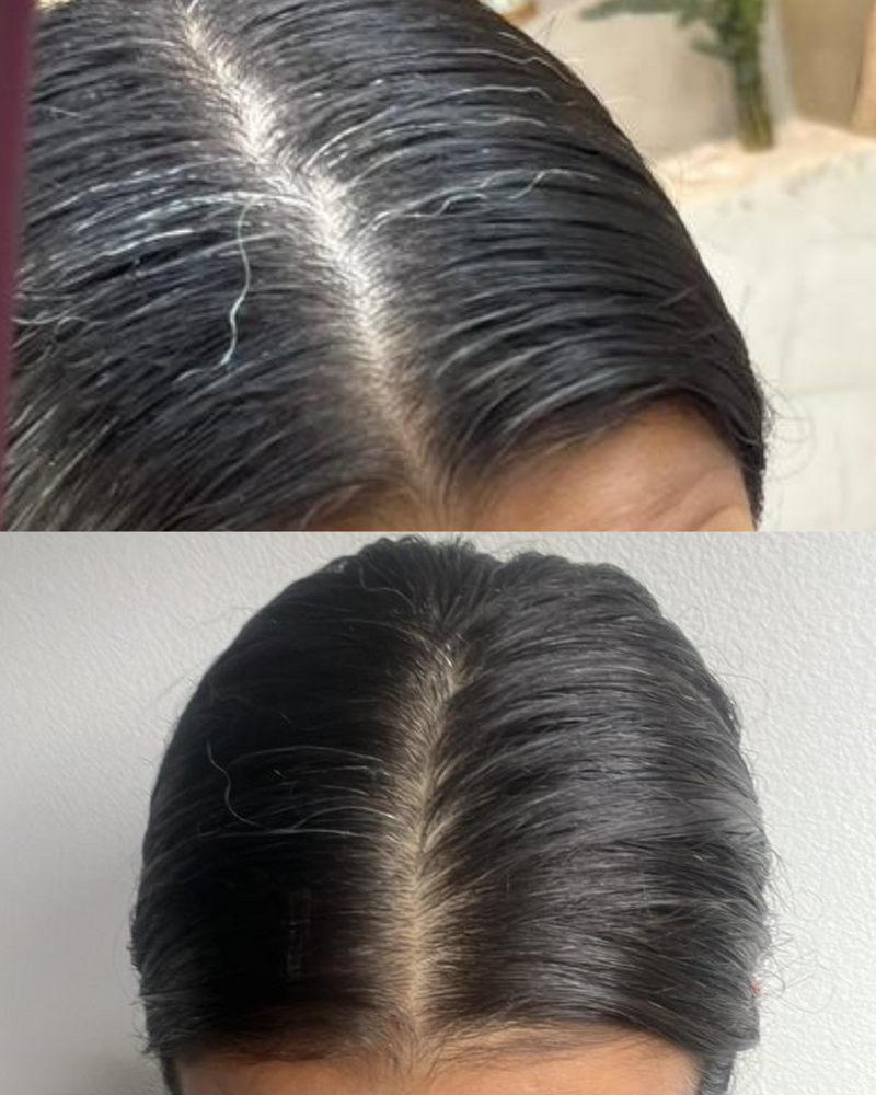 Reto de 30 dias para frenar la caida del pelo y canas con reflexologia facial