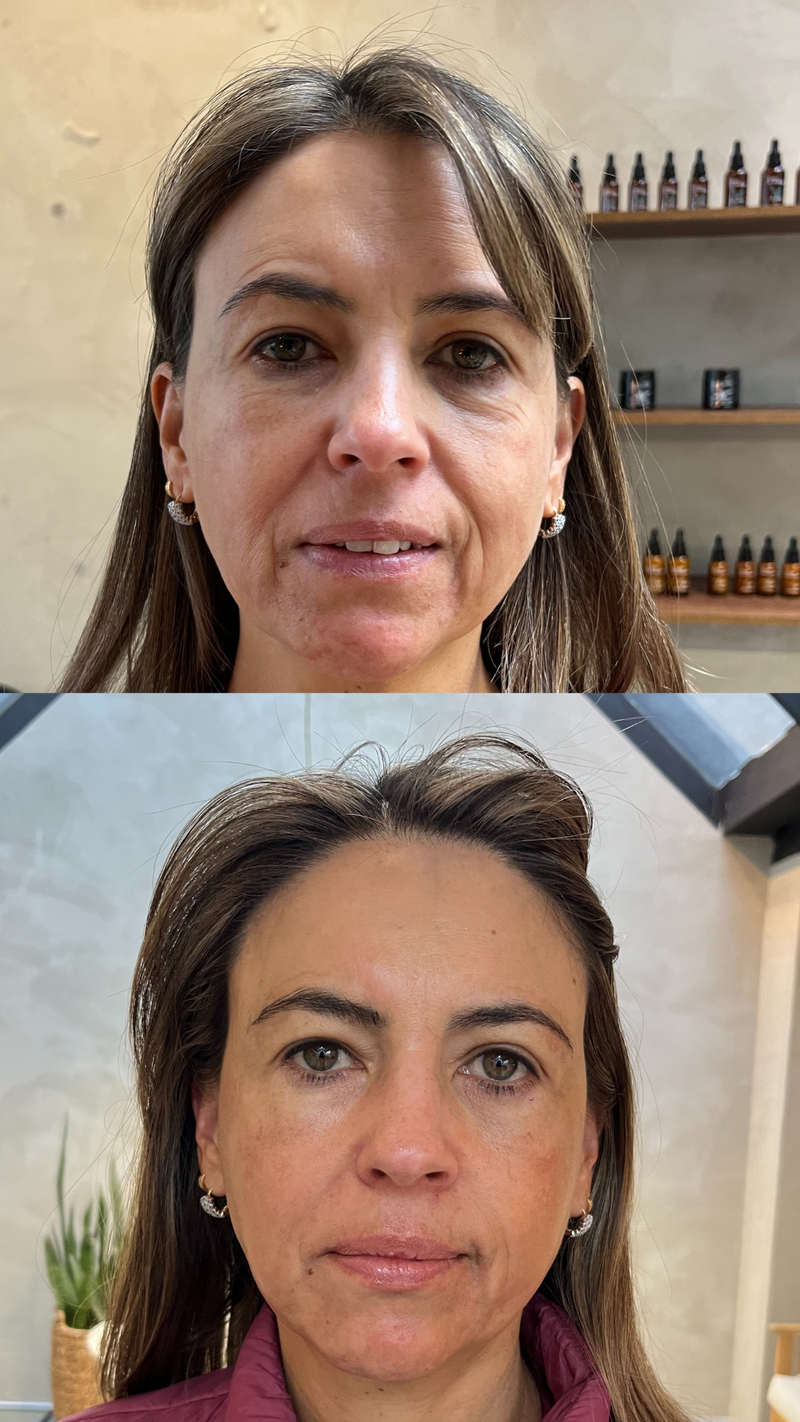 Curso Online Reflexología facial + Body talk ONLINE MARZO 2025
